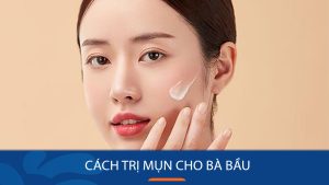 Bí quyết trị mụn trứng cá cho phụ nữ mang thai