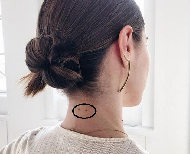 Người sở hữu 2 nốt ruồi ở gáy sẽ thấy họ là người ngay thẳng, lời nói có trọng lượng