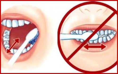 bị mòn chân răng bị mòn chân răng