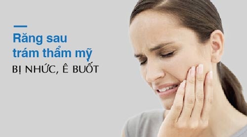 cách trị nhức răng sau khi trám