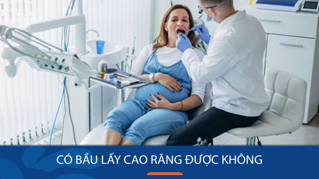Có bầu lấy cao răng được không? Lưu ý khi lấy cao răng