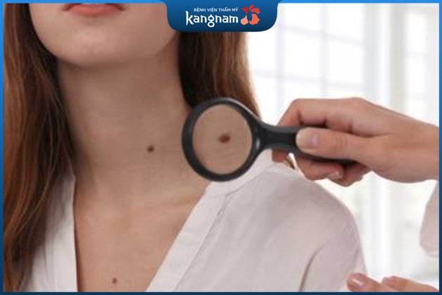 Tẩy nốt ruồi tùy theo sở thích và nhu cầu mỗi người