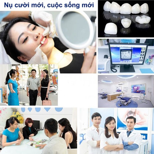 giá dán răng sứ giá dán răng sứ