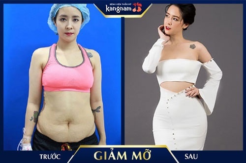 giảm béo bụng sau tết giảm béo bụng sau tết