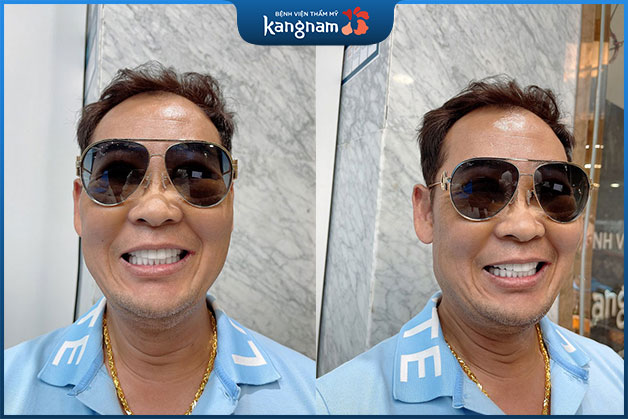 Khách hàng nam cười rạng rỡ khoe hàm răng trắng sáng