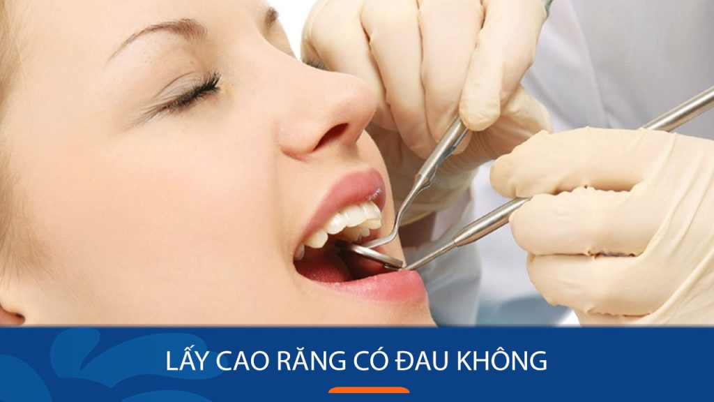 Lấy cao răng có đau không? Hướng dẫn giảm ê buốt