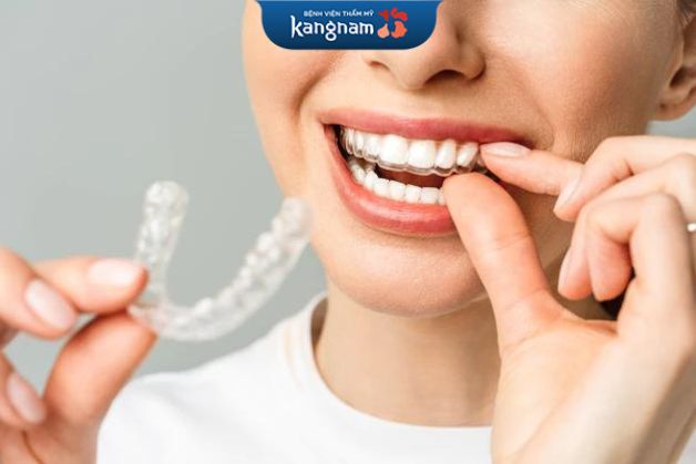 Sử dụng máng tẩy trẳng răng tại nhà