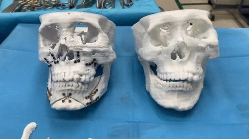 mỹ duyên lột xác tại kangnam