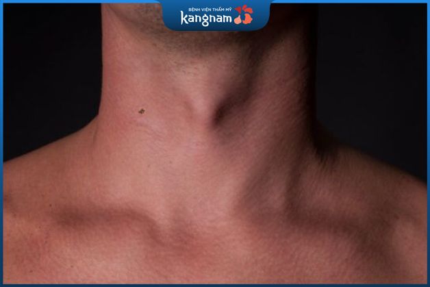 Người có nốt ruồi bên phải dù là cả nam hay nữ đều là những người có tính cách phóng khoáng