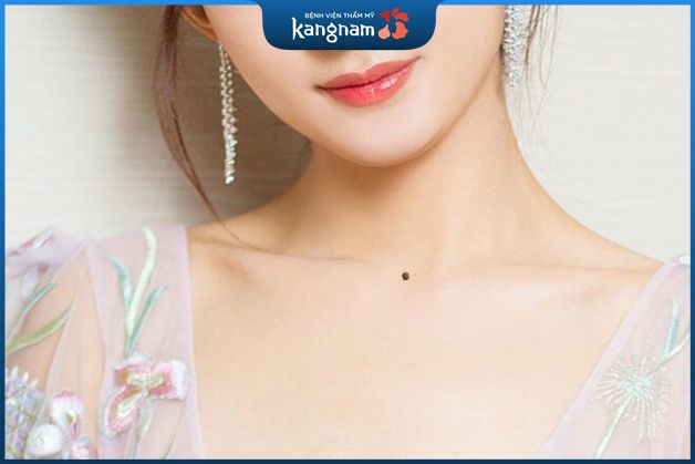 Nốt ruồi ở giữa cổ có nhiều may mắn