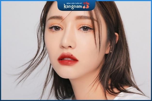 Người có nốt ruồi ở trên môi hay gặp may gặp mắn