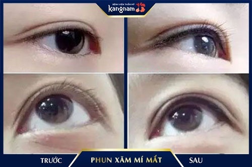 phun mí mắt kiêng gì