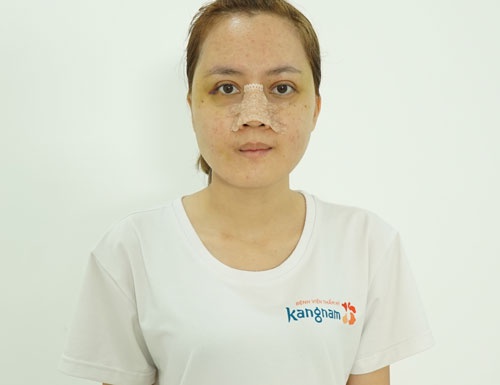 phùng thị mỹ duyên hồi phục sau 30 ngày