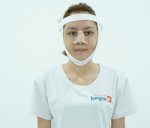 phùng thị mỹ duyên hồi phục