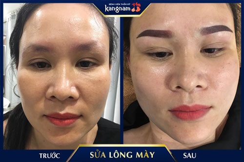 sửa chân mày xăm hư