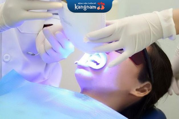 Có nên tẩy trăng răng không