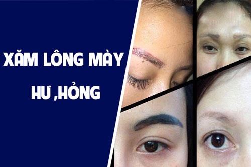 thảm họa xăm lông mày