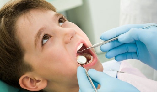 răng sữa có trám được không răng sữa có trám được không