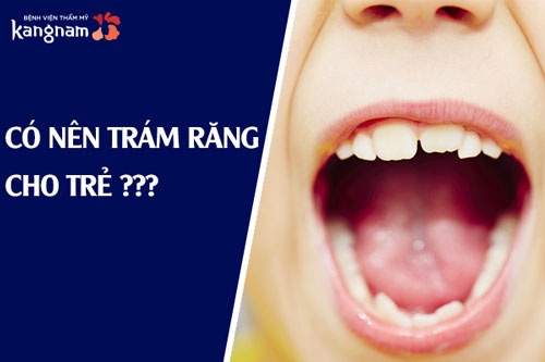 trám răng cho bé 3 tuổi trám răng cho bé 3 tuổi