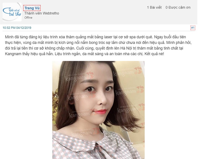 trị thâm mắt bằng laser có hiệu quả không