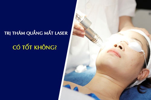 trị thâm quầng mắt bằng laser