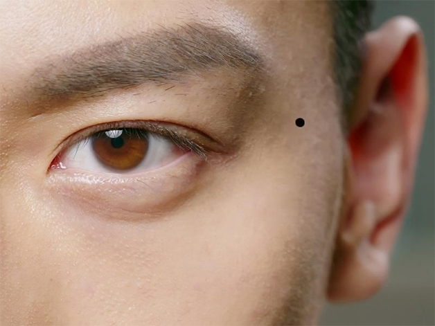 Mụn ruồi ở thái dương bên trái đàn ông lận đận chuyện tình cảm