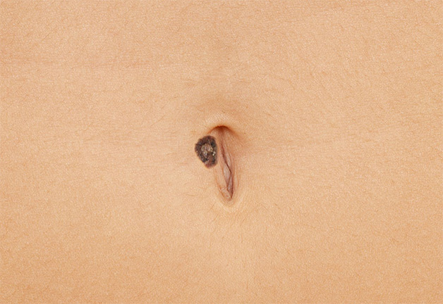 Gia chủ sở hữu nốt ruồi giữa rốn có đường công danh vô cùng sáng lạn, rộng mở