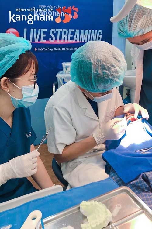 Quy trình bọc răng sứ tại Kangnam đảm bảo an toàn - hiệu quả chất lượng bọc răng sứ 2 răng cửa bị hô