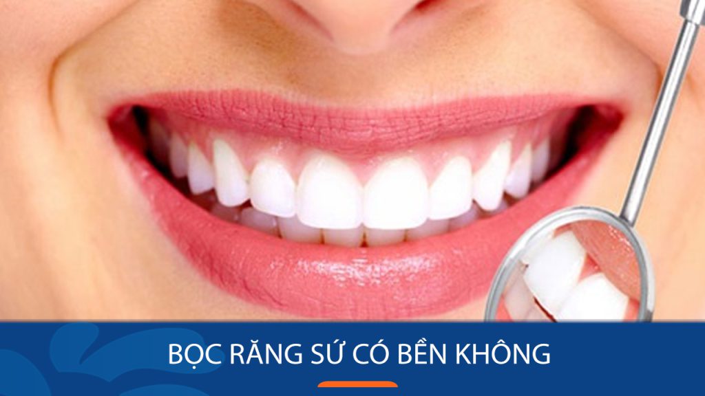 Bọc răng sứ có bền không? Có duy trì được vĩnh viễn không?