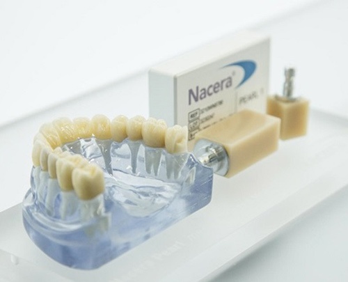 bọc răng sứ nacera