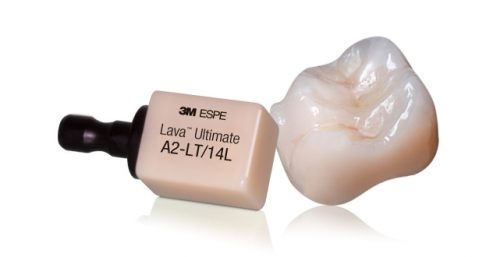 Mão răng Lava Ultimate phù hợp với đối tượng trồng răng Implant giá răng sứ lava plus