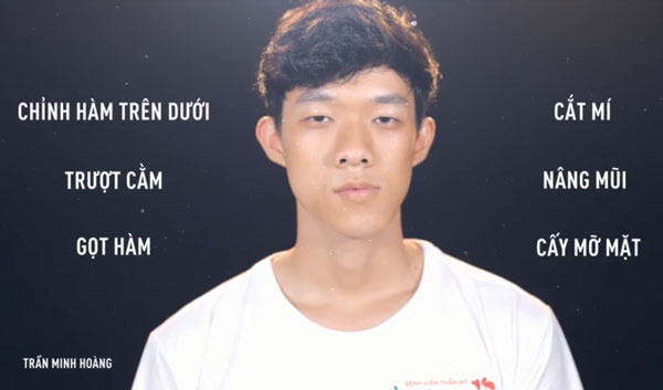 Chi tiết những vùng cần can thiệp trên gương mặt của chàng Dancer 