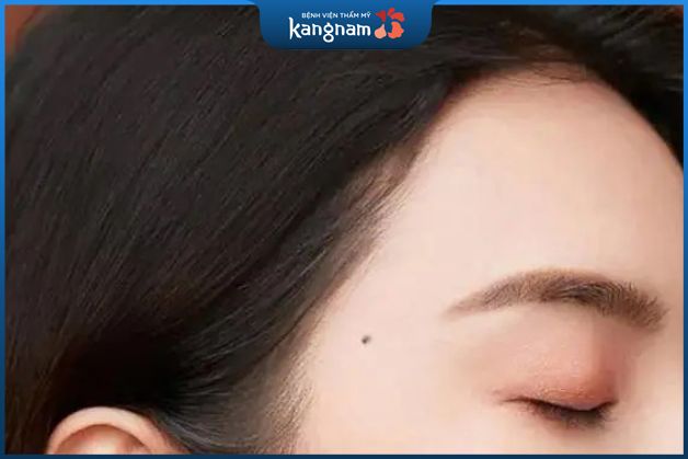 Ý nghĩa màu sắc nốt ruồi của nữ ở thái dương