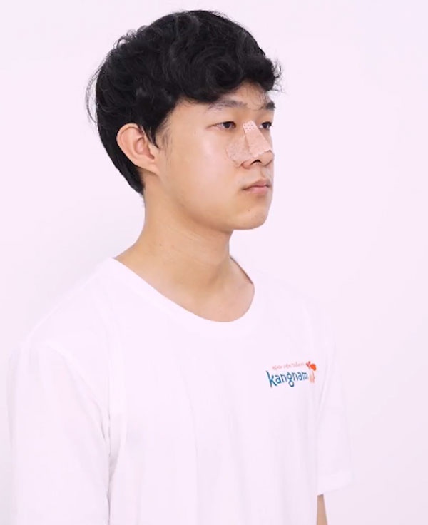 quá trình hồi phục của minh hoàng