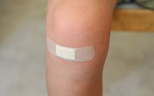 Băng vết thương hở để tránh lây nhiễm vi rút HPV mụn cóc có lây lan không