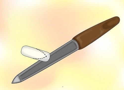 Cách làm răng thỏ tại nhà tiềm ẩn nhiều nguy cơ cho sức khỏe răng miệng làm răng thỏ đẹp