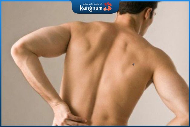 Nốt ruồi ở lưng bên phải nam giới là điềm tốt