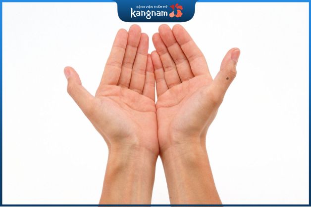 Nốt ruồi ngón cái nữ giới