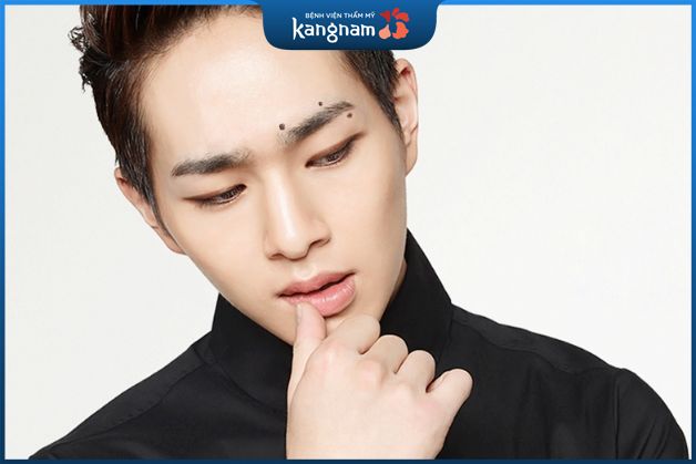 Nốt ruồi xung quanh lông mày thường gây cản trở công việc và gặp nhiều rủi ro