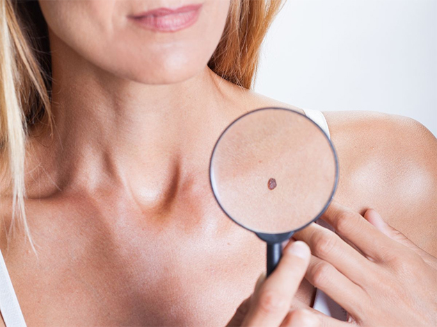 Ý nghĩa nốt ruồi ở vai gần cổ 