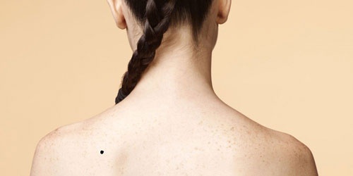 nốt ruồi trên vai phải phụ nữ