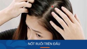 6 Vị trí nốt ruồi trên đầu tiết lộ điều gì về tính cách và vận mệnh của bạn?