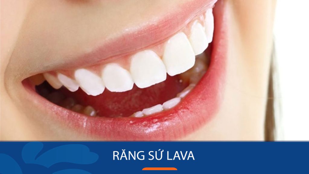 Răng sứ Lava là gì? Giá bao nhiêu tiền là rẻ nhất?
