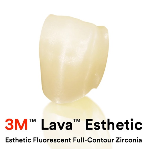 Răng sứ Lava Plus 3M ESPE có độ bền chắc cao, màu sắc tương tự răng thật răng sứ lava plus 3m espe