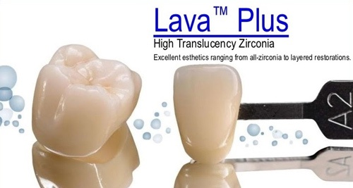 Mão răng sứ Lava được sử dụng phổ biến trong nha khoa hiện đại răng sứ lava plus