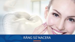 Răng sứ Nacera là gì? Có tốt không? Giá bao nhiêu tiền là rẻ nhất