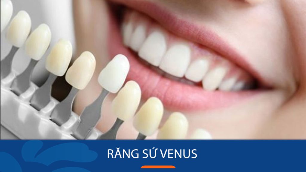 Răng sứ Venus có tốt không? Ưu điểm – nhược điểm của mão Venus Đức