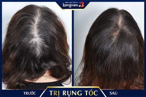 ăn gì để tóc mọc nhiều