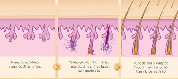 thực phẩm chống rụng tóc thực phẩm chống rụng tóc