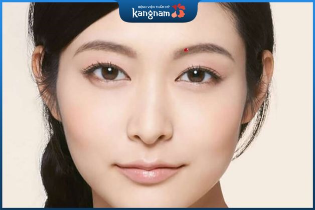 Nốt ruồi ở lông mày